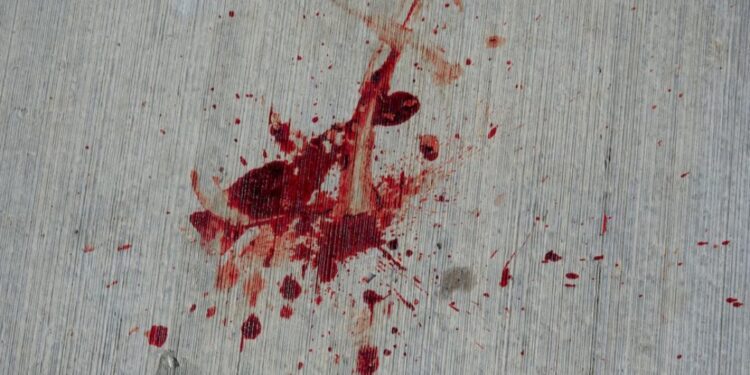 प्रेस मशीन वर काम करताना कामगाराची बोटे कापली, कंपनी मालक,व्यवस्थापक व डॉक्टरवर गुन्हा दाखल..